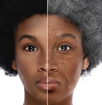 Before and after BAHI therapy